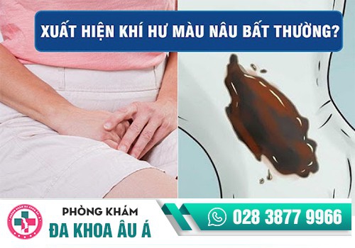 Chậm kinh ra máu màu nâu có nguy hiểm không?